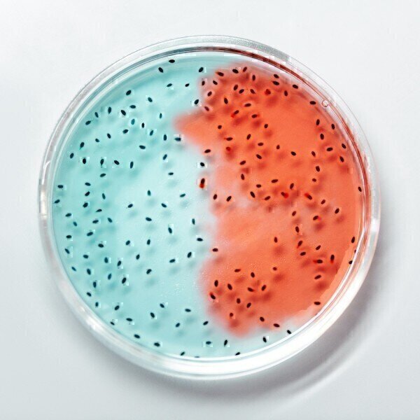 Bactérias em Alimentos - Tipos, Testes e Problemas Labmate Online